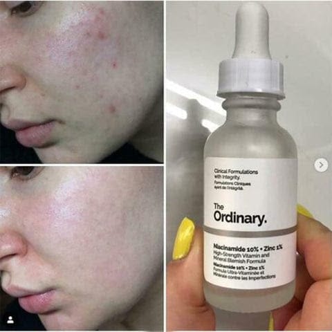 Ordinary Serum Niacinamide 10% + Zinc 1%